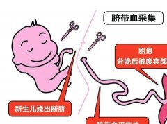 存脐带血保存费用一年多少钱?存脐带血可以治疗什么病