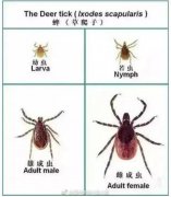 蜱虫咬人后有什么症状,蜱虫咬人的伤口图片