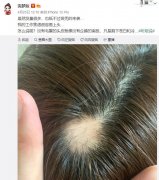 沈梦辰前后对比照,她和杜海涛分手是真的吗?